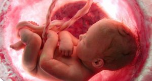 Новосибирские врачи просили мать сиамских близнецов прервать беременность